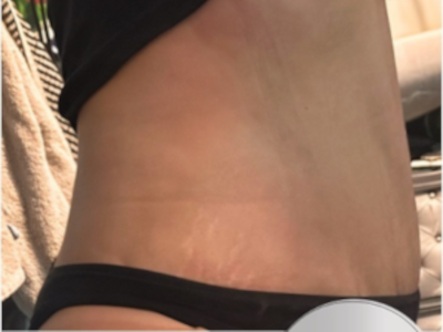 Dr Faten Ben Rhouma, chirurgien esthétique à Tunis