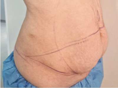 Dr Faten Ben Rhouma, chirurgien esthétique à Tunis