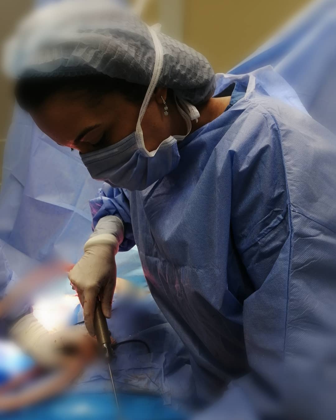 Lipofilling Des Fesses - Consultation et intervention chirurgicale